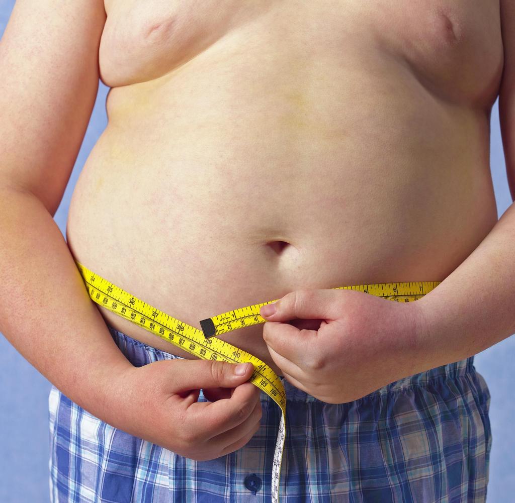 Magenverkleinerung in Antalya: die Lösung für fettsüchtige Kinder?