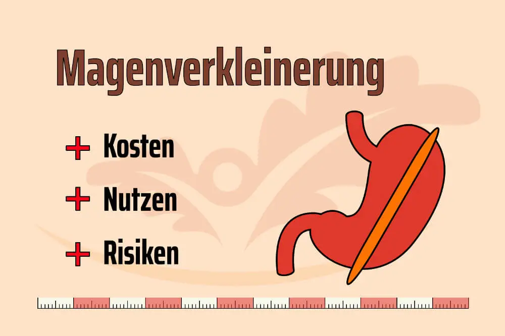 Magenverkleinerung in der Türkei: zu erschwinglichen Preisen